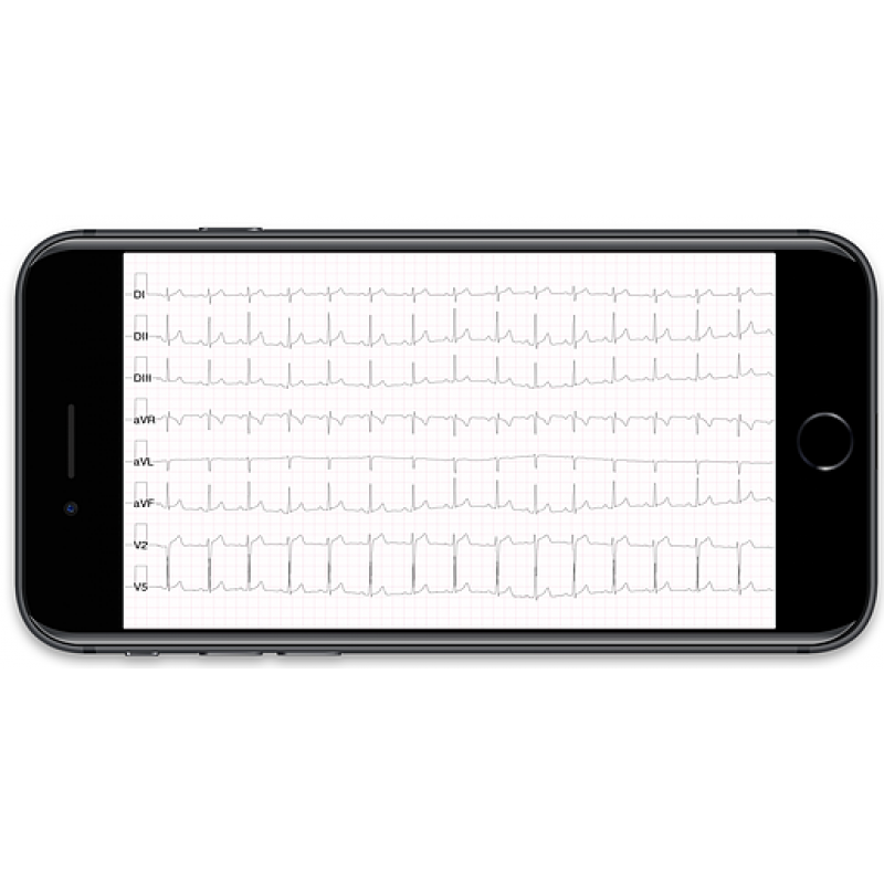 DHeart Portable 12Lead Smartphone ECG EKG Bluetooth Heart Rate